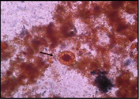 Sexual Jurisprudence - 3 Chapter Notes - Forensic Medicine and ...