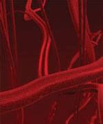 What is Leukoaraiosis & White Matter Disease? - Life Extension