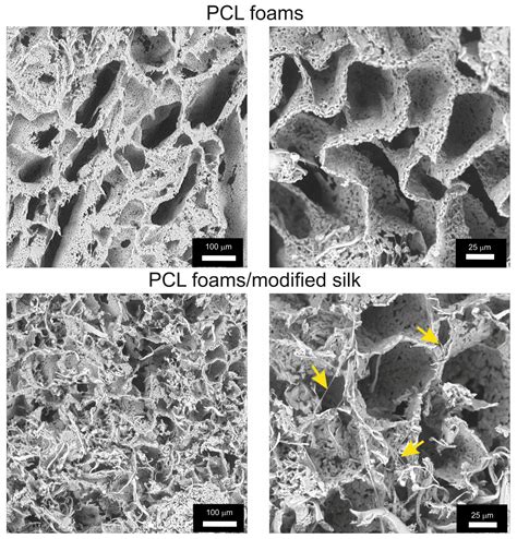 Caddisfly Silk-Polycaprolactone Foams: Physicochemical and Biological ...