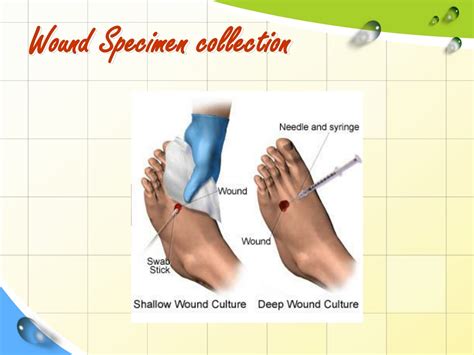 PPT - Pus (Abscesses, and sinuses) wound, and Burn Cultures PowerPoint ...