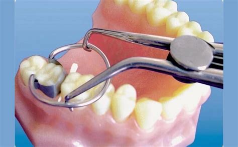 InstruDent Russia Tor Vm Forceps for Sectional Matrices Ring (1.099-1 ...