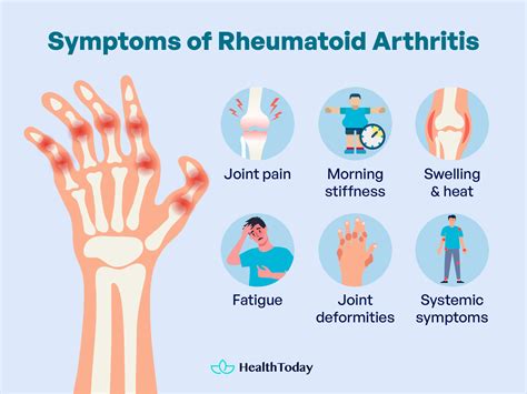 Symptoms and Long Term Effects of Rheumatoid Arthritis - HealthToday