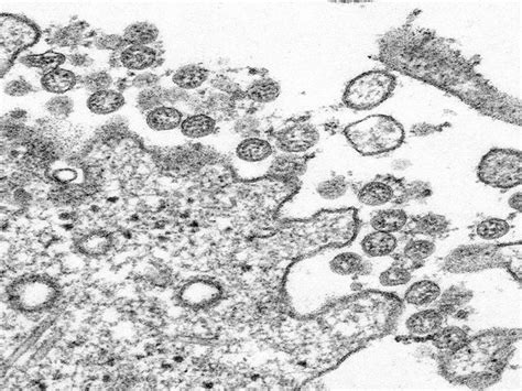 Coronavirus attaches to receptor on respiratory cells, hijack them to ...