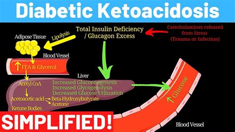 0.3 ketones in blood diabetes