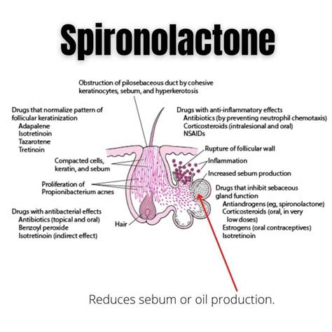 Spironolactone - Dr Davin Lim