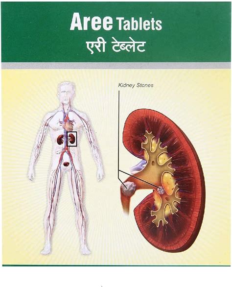 Dhanvantari Aree 500 Tablets Useful in Urinary India | Ubuy