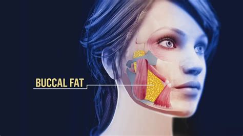 Watch TODAY Excerpt: Buccal fat removal: Inside latest trend to reshape the face - NBC.com
