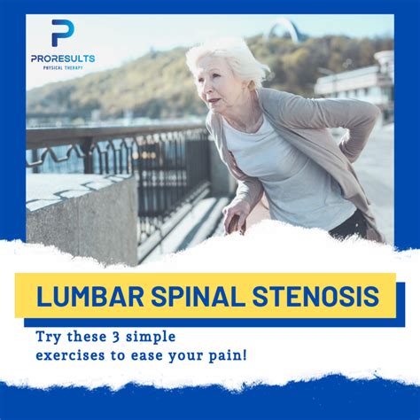 3 Exercises to Ease Lumbar Spinal Stenosis - ProResults Physical Therapy