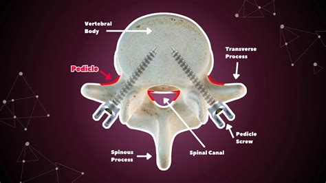 Vertebral Pedicles: Anatomy, Function, and Spine Surgery | Ruthless Spine