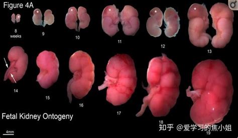 胎儿哪几周最容易畸形的 胎儿畸形是不是一定不能要-趣丁网