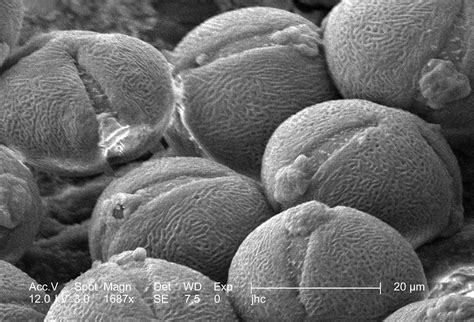 Scanning Electron Micrograph 的图像结果