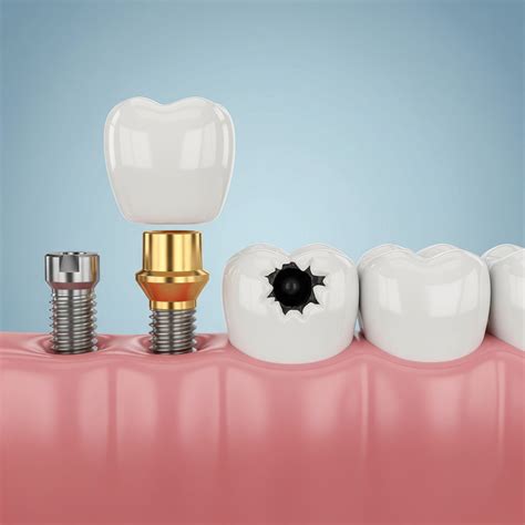 Dentist Near Me | Dental Care | Today's Dental