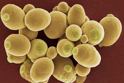【女性生殖系统菌群之五】生殖系统菌群在人类疾病中的作用 - 知乎