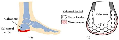 Mechanical Modeling of Healthy and Diseased Calcaneal Fat Pad Surrogates