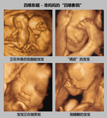 胎儿发育标准对照表|你的胎儿发育正常吗？