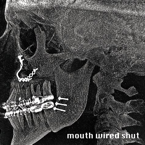 Mouth Wired Shut Mouth Wired Shut (CD) (UK IMPORT) 884501629393| eBay