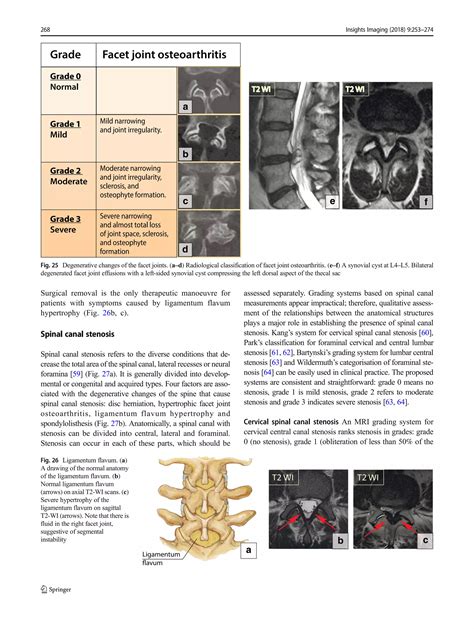 Abcs of the degenerative spine | PDF