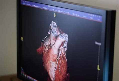 Heart checkup: 9 tests that can make a difference | Northwell Health