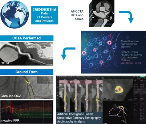 Cleerly Heart Testing and Heart Treatment - Preventive Cardiology: It's about time!