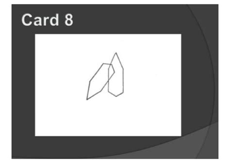 SOLUTION: Bender gestalt test cards - Studypool