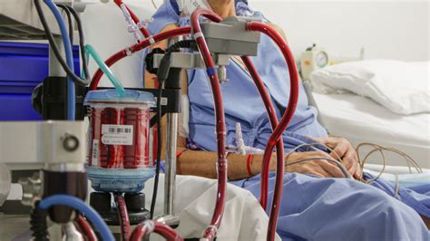 ECMO: the value of experience and technology in optimizing outcomes - FCV