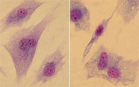 Complementation Test Kit 的图像结果