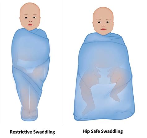 Swaddling And Colic at Keith Faria blog