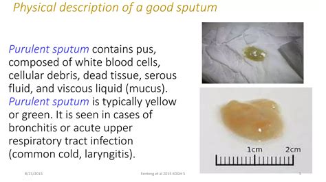 Sputum Examination and Analysis | PPTX