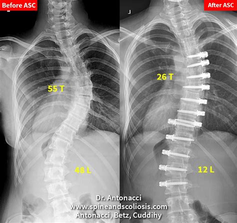 Mittal Spine Center : Skill to Heal, Spirit to Care