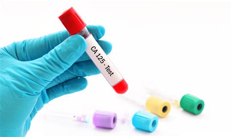 CA-125 Blood Test | Private Blood Screening