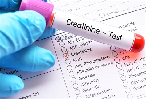 Understanding Creatinine Levels In Blood Work | The Well by Northwell
