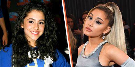 Has Ariana Grande Had Plastic Surgery? Experts Differed in Their Opinions