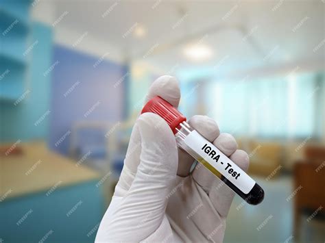 Premium Photo | Blood sample for IGRA interferon gamma release assay ...