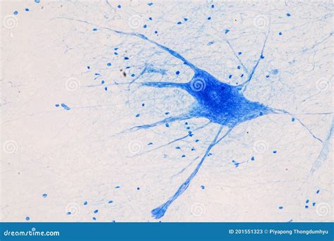 Motor Neuron Under the Microscope. Stock Image - Image of cellular ...