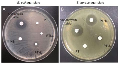 LL-37-Coupled Porous Composite Scaffold for the Treatment of Infected ...