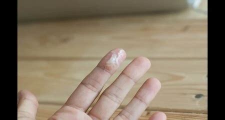 Vaginal Discharge- Causes, Color Guide And Treatments