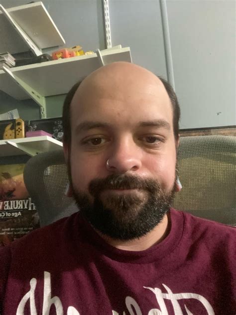 If you guys ever feel bad about being bald, just know my last name is ...