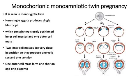 Anatomy of twin pregnancy | PPTX