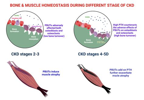 The Potential Influence of Uremic Toxins on the Homeostasis of Bones ...