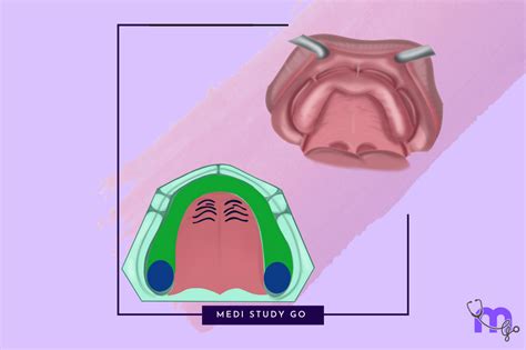 Maxillary Anatomical Landmarks: Detailed Examination – Medi Study Go