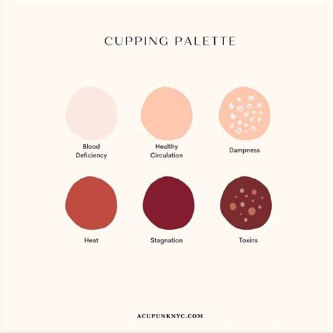 Cupping Mark Reference Guide | Cupping therapy, Cupping massage, Cupping treatment