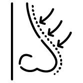 Rhinoplasty in Coimbatore | Nose reshaping, nose correction surgery in ...