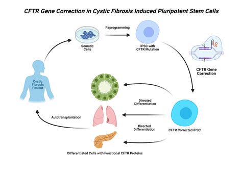 Curative Measures for Cystic Fibrosis: A Perspective on Current Stem ...