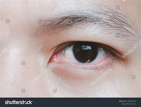 Black Eyed Humans