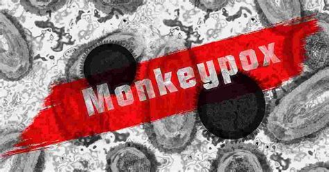 Fact Check: Is Monkeypox an airborne disease that can cause paralysis ...