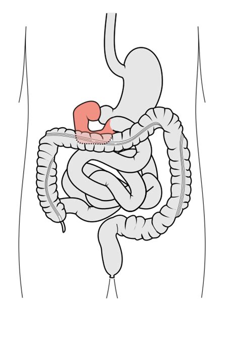 Image result for Duodenum Part