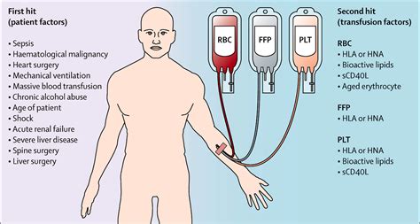Transfusion-related acute lung injury: a clinical review - The Lancet
