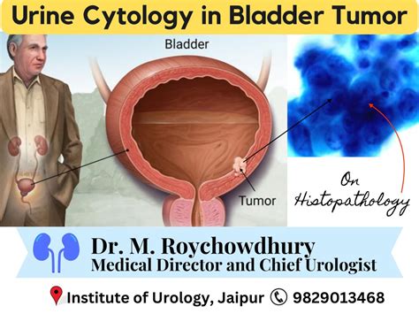 Role of Urine Cytology in Bladder Tumor Detection and Management