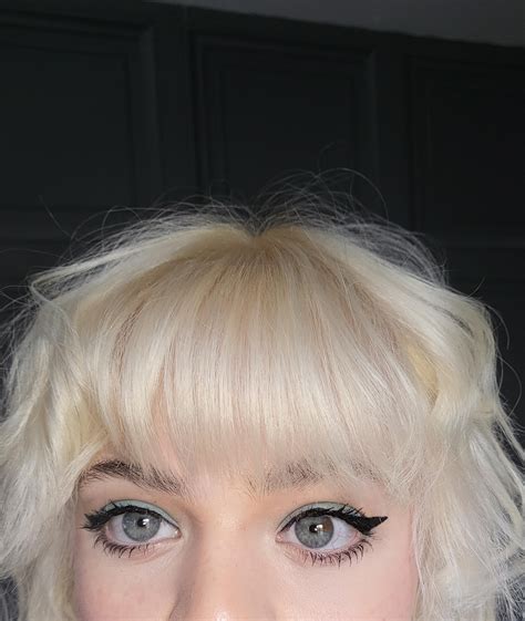 I've always had a brown speck in my eye, any idea what it is? Thank you! And I'm guessing the ...