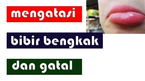 cara mengatasi bengkak akibat gigitan serangga